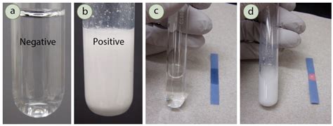 silver nitrate test positive result